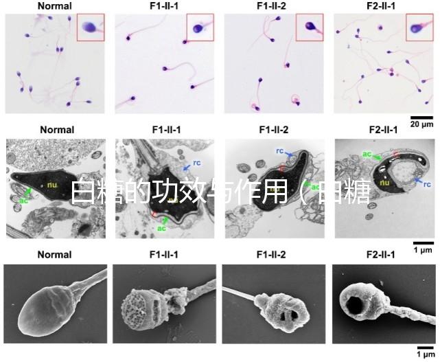 白糖的功效與作用(白糖的功效與作用及營養(yǎng)價(jià)值)