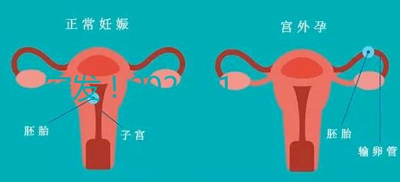 突發(fā)！2024.11.15，天津試管嬰兒納入醫(yī)保報(bào)銷（附14家醫(yī)保定點(diǎn)醫(yī)院）