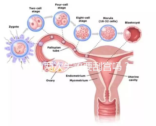移植兩次失敗要刮宮嗎？做試管前這些問題得知道