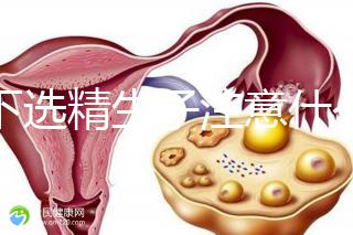 私下選精生子注意什么細節(jié)要早知，選擇正規(guī)機構(gòu)最重要