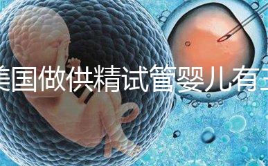 美國做供精試管嬰兒有三大條件,想知道需不需要結婚證戳