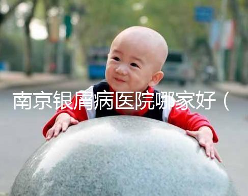 南京銀屑病醫(yī)院哪家好（南京專(zhuān)門(mén)看銀屑病醫(yī)院）