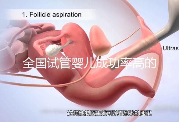 全國試管嬰兒成功率高的醫院有哪些？（全國試管嬰兒成功率高的醫院目錄一覽）