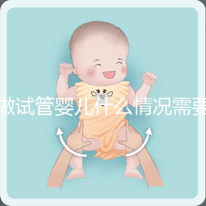 做試管嬰兒什么情況需要做染色體檢查？