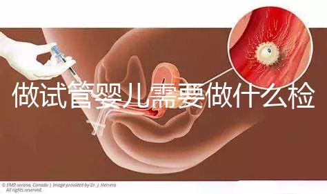 做試管嬰兒需要做什么檢查（做試管嬰兒需要做什么檢查？）