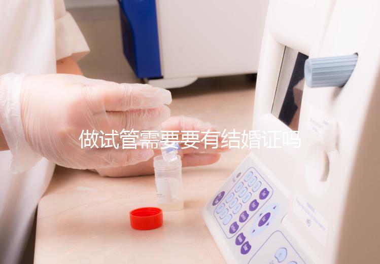 做試管需要要有結婚證嗎？做試管需要結婚證