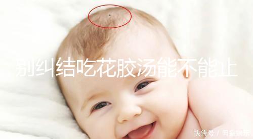 別糾結吃花膠湯能不能止孕吐了,美容、養(yǎng)顏…還有這6大好處