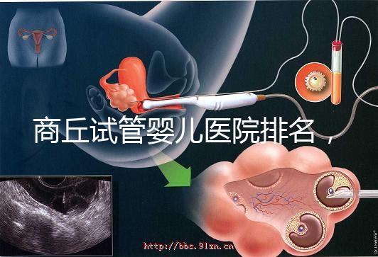 商丘試管嬰兒醫(yī)院排名，附3家公立機構(gòu)助孕成功率和費用