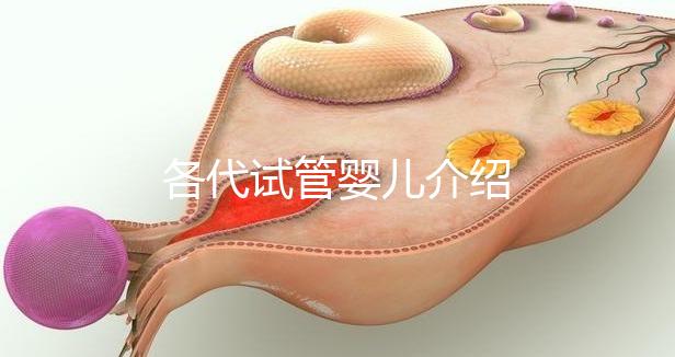 各代試管嬰兒介紹