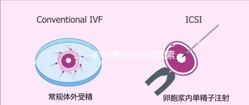 二、影響費用的關鍵因素