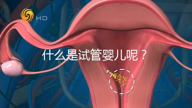 什么是試管嬰兒呢？