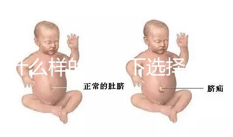 什么樣的情況下選擇做試管嬰兒？