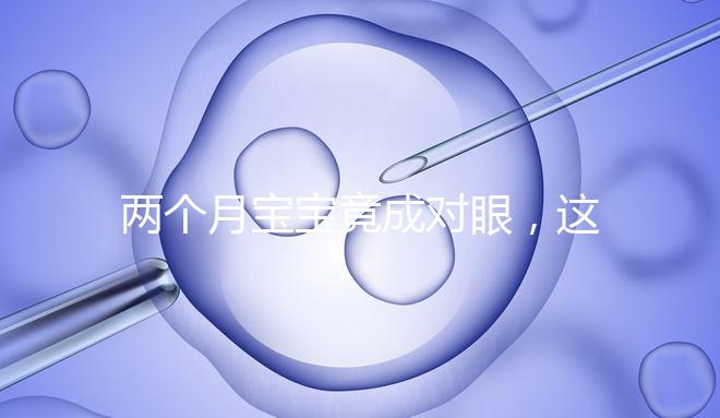 兩個(gè)月寶寶竟成對(duì)眼,這5大形成原因家長必知