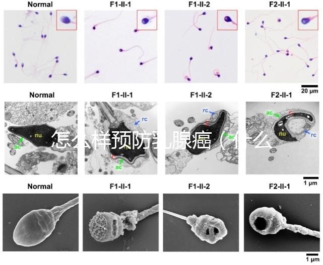 怎么樣預防乳腺癌(什么人容易得乳腺癌)
