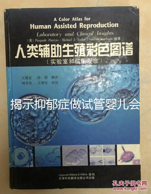 揭示抑郁癥做試管嬰兒會遺傳給女兒，想避免看這個