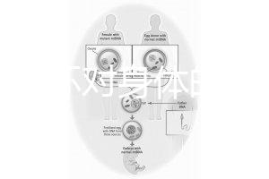 揭秘上環(huán)對(duì)身體的5大壞處，女人別再無知了