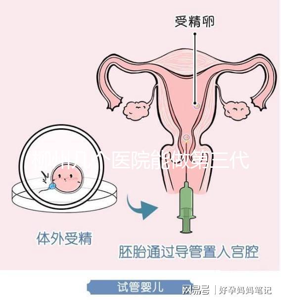 柳州幾個醫院能做第三代試管嬰兒？詳細的費用成功率都在這