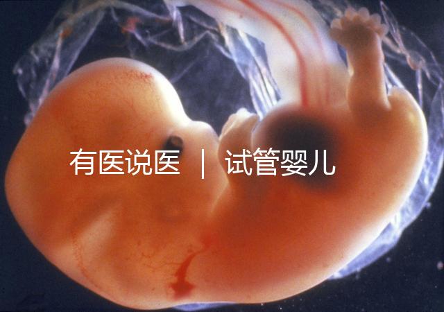 有醫(yī)說醫(yī) ｜ 試管嬰兒技術(shù)不能避免宮外孕，“三孩”時代警惕宮外孕發(fā)生率增加