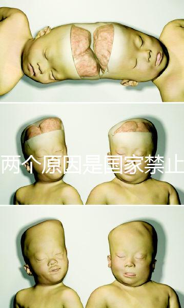 有兩個原因是國家禁止中非混血中國會接受嗎？