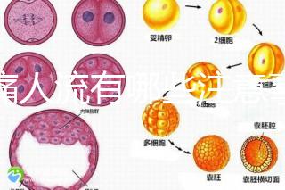 無痛人流有哪些注意事項？