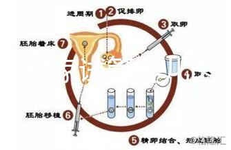 浙江27家試管嬰兒醫院成功率排名公開,邵逸夫醫院位居前十
