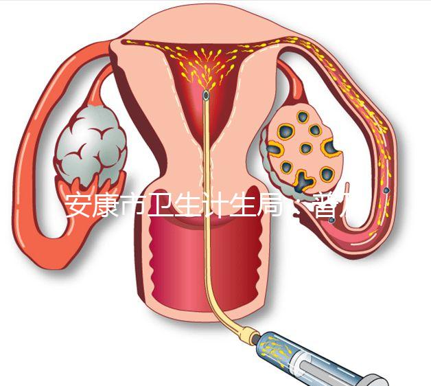 安康市衛(wèi)生計生局:普及優(yōu)生優(yōu)育五項檢查相關知識