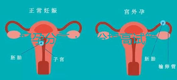 好孕分享：這份提高試管移植著床率的偏方快收藏！全是干貨