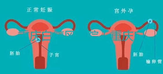 重慶白癜風醫院(重慶白癜風專科醫院在哪里)