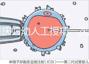 重慶婦幼人工授精一次成功率揭秘,移植費(fèi)用貴有原因