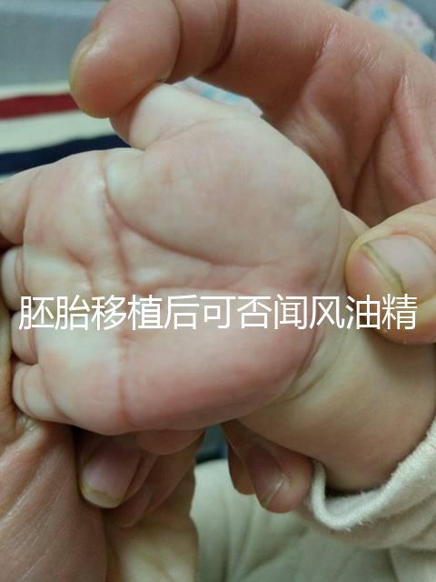 胚胎移植后可否聞風油精速覽，導致著床失敗真不是鬧著玩