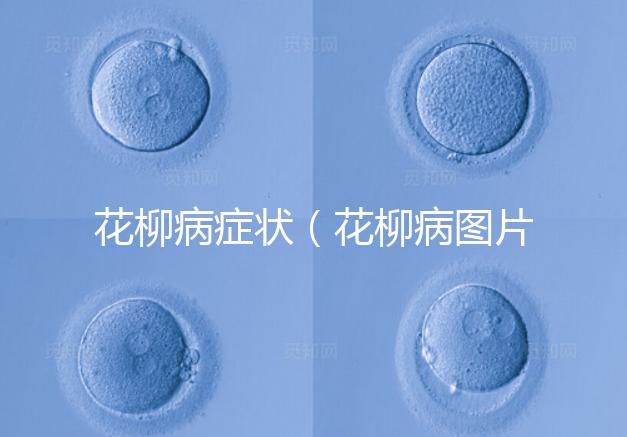 花柳病癥狀(花柳病圖片初期)