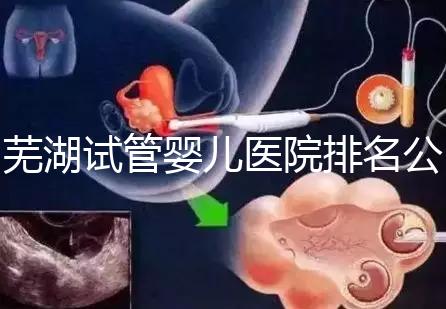 蕪湖試管嬰兒醫(yī)院排名公開，弋磯山醫(yī)院、蕪湖二院獲好評