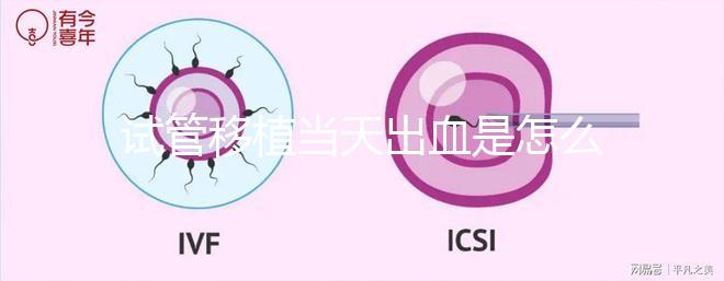 試管移植當天出血是怎么回事？收好你的“玻璃心”別太擔心