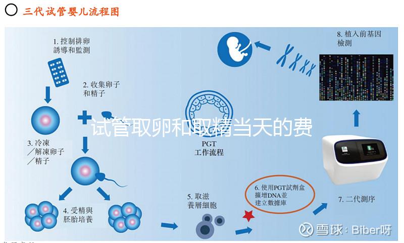 試管取卵和取精當天的費用明細表，大概多少錢一清二楚