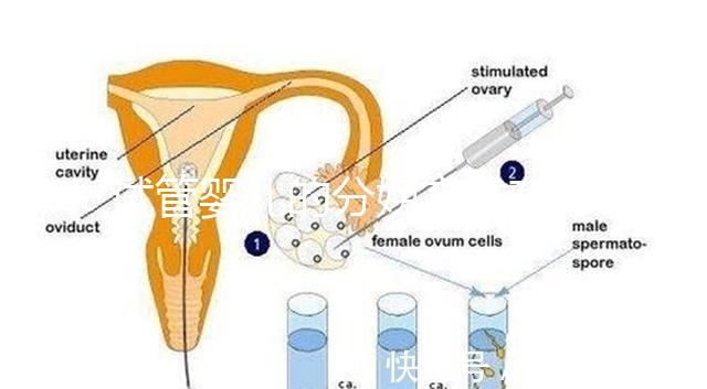 試管嬰兒的分娩方式有哪些？能否自然分娩取決于情況