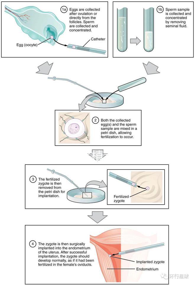試管嬰兒移植手術（試管嬰兒移植手術需要多長時間）