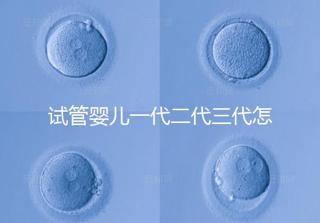 試管嬰兒一代二代三代怎么選？