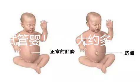 試管嬰兒費用大約多少2021年：一二三代試管分別指的是什么？