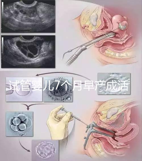 試管嬰兒7個月早產(chǎn)成活率高達80%！能不能要看身體狀況