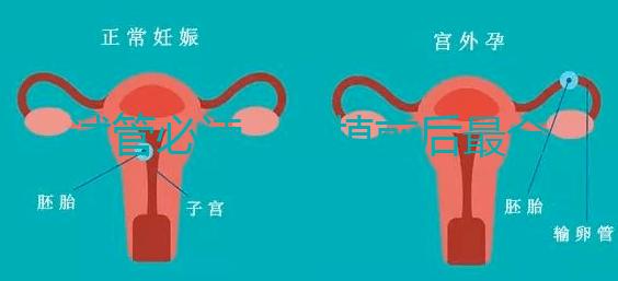 試管必讀，移植前后最全注意事項？