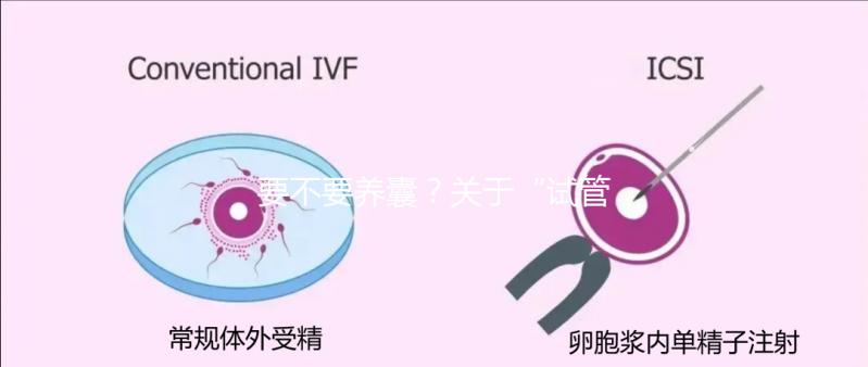 要不要養囊？關于“試管養囊”你是否會有很多問號？