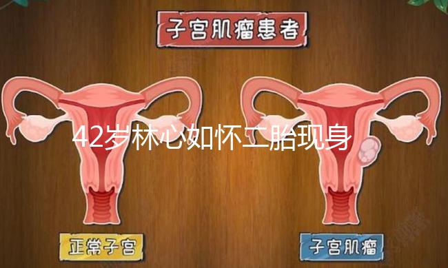 42歲林心如懷二胎現身新活動，霍建華全程陪同產檢回應