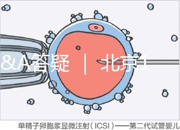 Q&A答疑 ｜ 北京16項輔助生殖技術進醫保，試管可以報銷嗎？