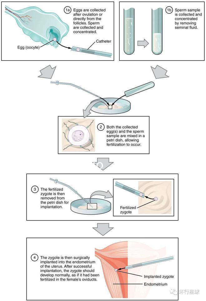Reprod. Biomed：奇跡、突破、爭(zhēng)議、反思——“試管嬰兒”40年