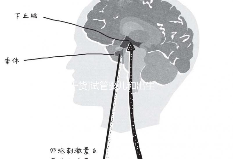 [干貨]試管嬰兒和出生缺陷